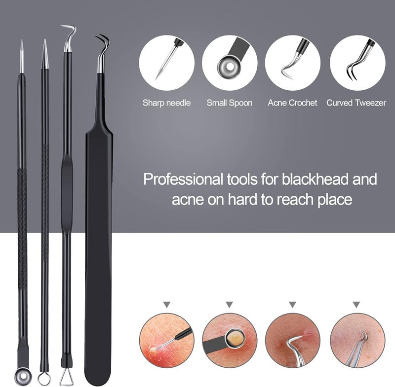 MENOLY Pimple Popper Tool Kit 10 Pcs Blackhead Remover Tool Zit Popper for Blemish, Pimple Comedone Extractor Acne Tool for Blackheads, Acnes, Whiteheads Nose Face Tools with Leather Bag - Image 3